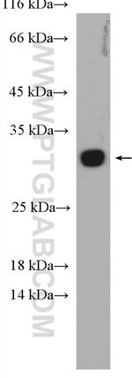 RAB5B Antibody in Western Blot (WB)