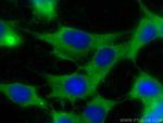 PDCD1LG2/PD-L2 Antibody in Immunocytochemistry (ICC/IF)