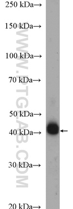 HLA-E Antibody in Western Blot (WB)