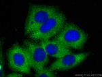 BMX Antibody in Immunocytochemistry (ICC/IF)