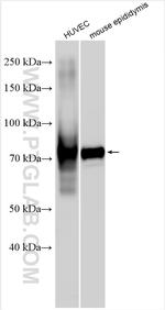 BMX Antibody in Western Blot (WB)