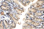 TXNIP Antibody in Immunohistochemistry (Paraffin) (IHC (P))