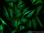 NODAL Antibody in Immunocytochemistry (ICC/IF)