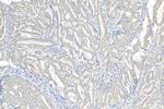 NODAL Antibody in Immunohistochemistry (Paraffin) (IHC (P))
