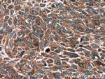 BRAP Antibody in Immunohistochemistry (Paraffin) (IHC (P))