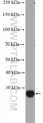 RAB34 Antibody in Western Blot (WB)