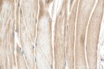 SULF1 Antibody in Immunohistochemistry (Paraffin) (IHC (P))