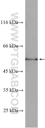 SELENBP1 Antibody in Western Blot (WB)