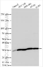 ABCA3 Antibody in Western Blot (WB)