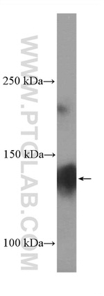 CACNA2D1 Antibody in Western Blot (WB)