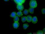 PLCB2 Antibody in Immunocytochemistry (ICC/IF)
