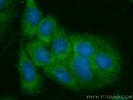 HSD17B12 Antibody in Immunocytochemistry (ICC/IF)