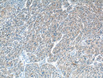 TRIM8 Antibody in Immunohistochemistry (Paraffin) (IHC (P))
