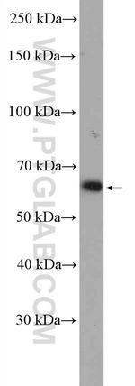 TRIM8 Antibody in Western Blot (WB)