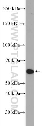 TRIM8 Antibody in Western Blot (WB)