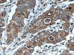 ATG4A Antibody in Immunohistochemistry (Paraffin) (IHC (P))