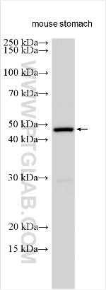 KIFC2 Antibody in Western Blot (WB)