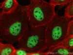 C1orf77 Antibody in Immunocytochemistry (ICC/IF)