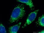 MRPL4 Antibody in Immunocytochemistry (ICC/IF)