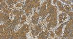 RARRES1 Antibody in Immunohistochemistry (Paraffin) (IHC (P))