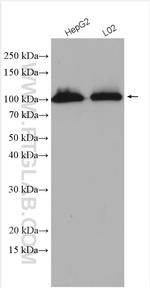 DHTKD1 Antibody in Western Blot (WB)