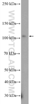 DHTKD1 Antibody in Western Blot (WB)