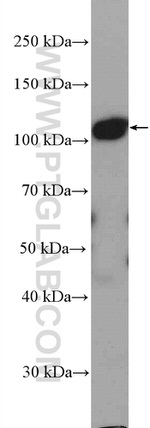 DHTKD1 Antibody in Western Blot (WB)