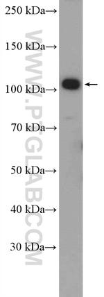 DHTKD1 Antibody in Western Blot (WB)