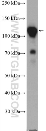 GTF3C2 Antibody in Western Blot (WB)