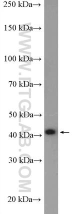 Reticulocalbin 3 Antibody in Western Blot (WB)
