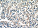MOCS3 Antibody in Immunohistochemistry (Paraffin) (IHC (P))
