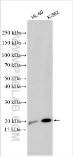LARP6 Antibody in Western Blot (WB)