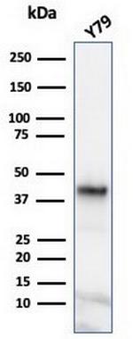 Glutamine Synthetase/GLUL Antibody in Western Blot (WB)