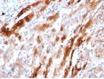 Glutamine Synthetase/GLUL Monoclonal Antibody (GLUL/6604)