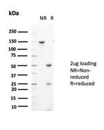 Glutamine Synthetase/GLUL Antibody in Immunoelectrophoresis (IE)