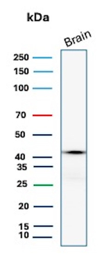 Glutamine Synthetase/GLUL Antibody in Western Blot (WB)