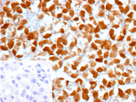 Glutamine Synthetase/GLUL Antibody in Immunohistochemistry (Paraffin) (IHC (P))