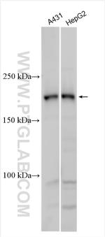 Supervillin Antibody in Western Blot (WB)