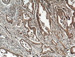 IRE1/ERN1 Antibody in Immunohistochemistry (Paraffin) (IHC (P))