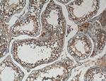 IRE1/ERN1 Antibody in Immunohistochemistry (Paraffin) (IHC (P))