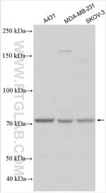 TMEM45A Antibody in Western Blot (WB)