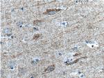 SYNDIG1 Antibody in Immunohistochemistry (Paraffin) (IHC (P))