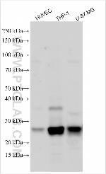 CTSS Antibody in Western Blot (WB)