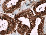 Livin Antibody in Immunohistochemistry (Paraffin) (IHC (P))