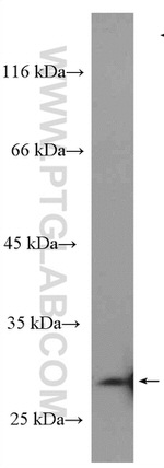 Livin Antibody in Western Blot (WB)