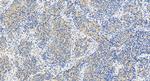 ECSIT Antibody in Immunohistochemistry (Paraffin) (IHC (P))