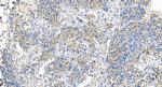 ECSIT Antibody in Immunohistochemistry (Paraffin) (IHC (P))