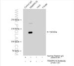 TRAPPC10 Antibody in Immunoprecipitation (IP)
