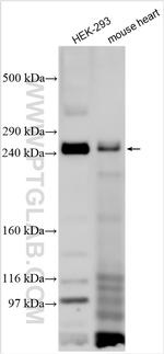 SCN2A Antibody in Western Blot (WB)