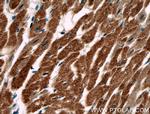 AKD2 Antibody in Immunohistochemistry (Paraffin) (IHC (P))